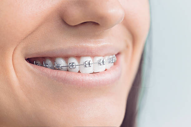 Best Dental X-Rays and Imaging  in Warren, OH